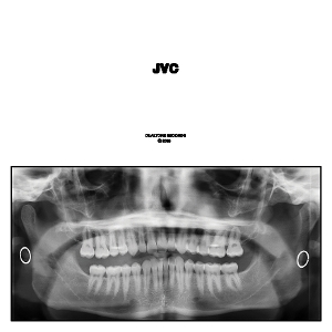Jvc