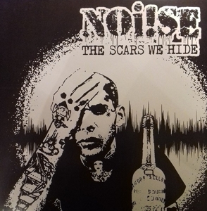 Scars We Hide